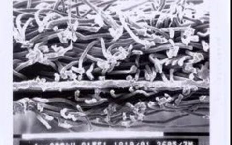 东方雨虹 防水透汽膜——让您的房子会“呼吸”